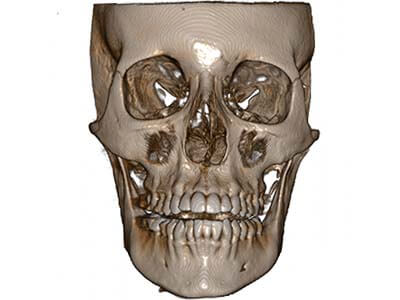 Insights Diagnostic CBCT Scan Services 13x16